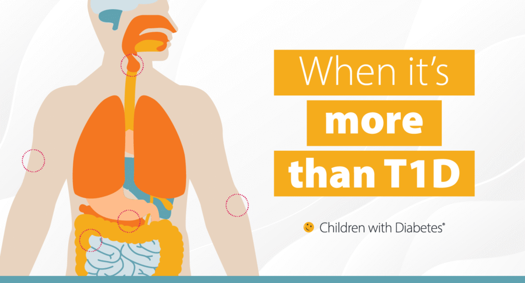 Barbie’s New T1D Doll Is More Than a Toy—It’s a Revolution in Representation